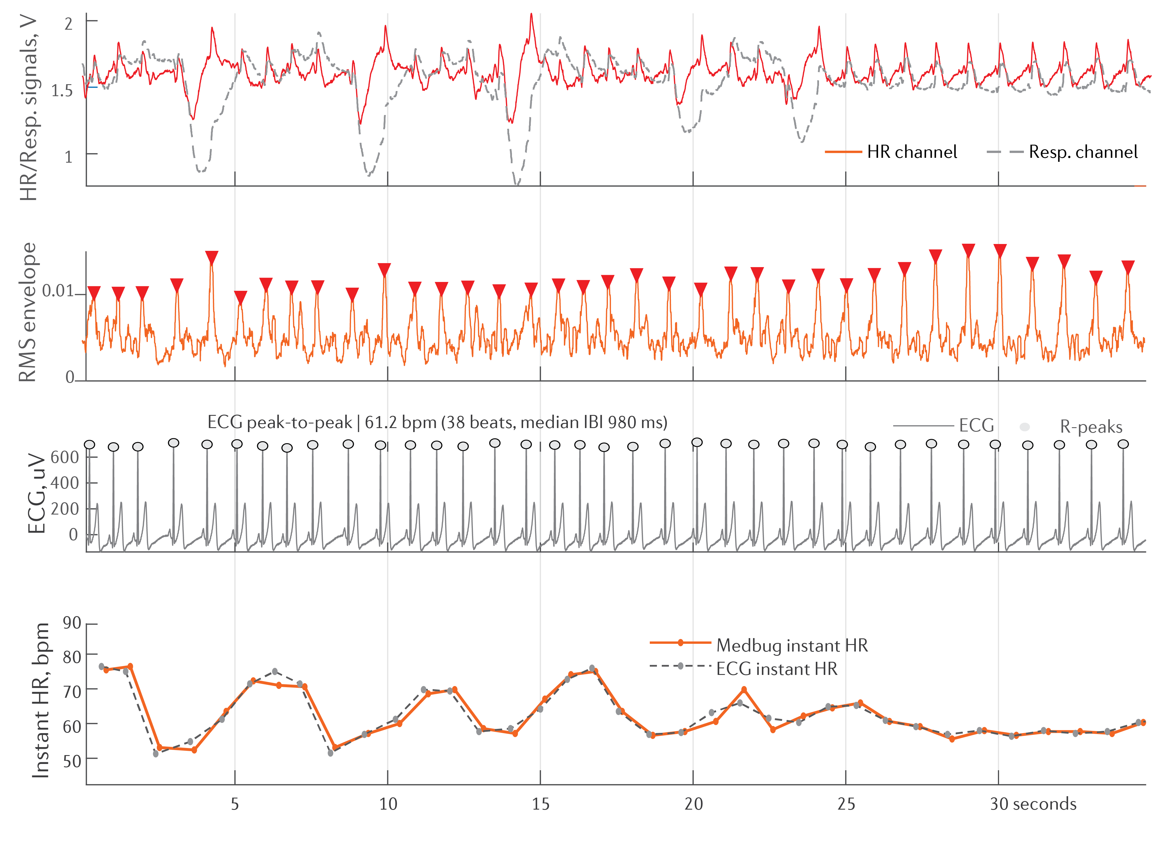 MedBug heart-rate and respiratory signals compared with reference ECG, including instantaneous HR tracking