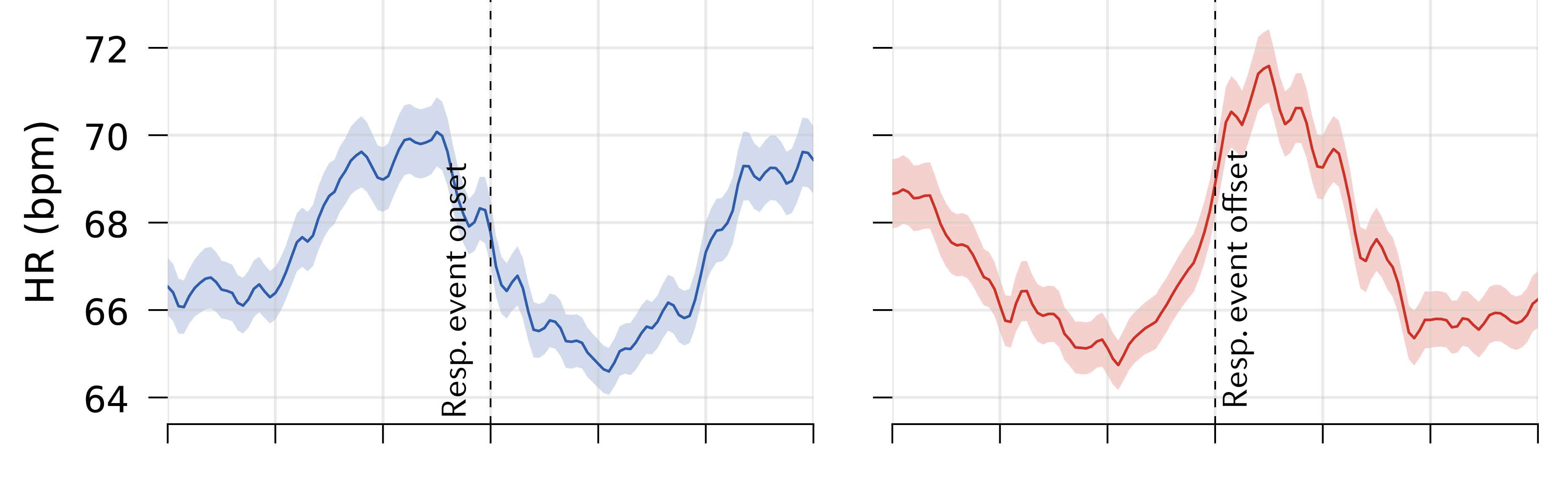 Average heart rate around sleep apnoea onset and offset for one participant, showing a dip during the pause and a rebound when breathing resumes