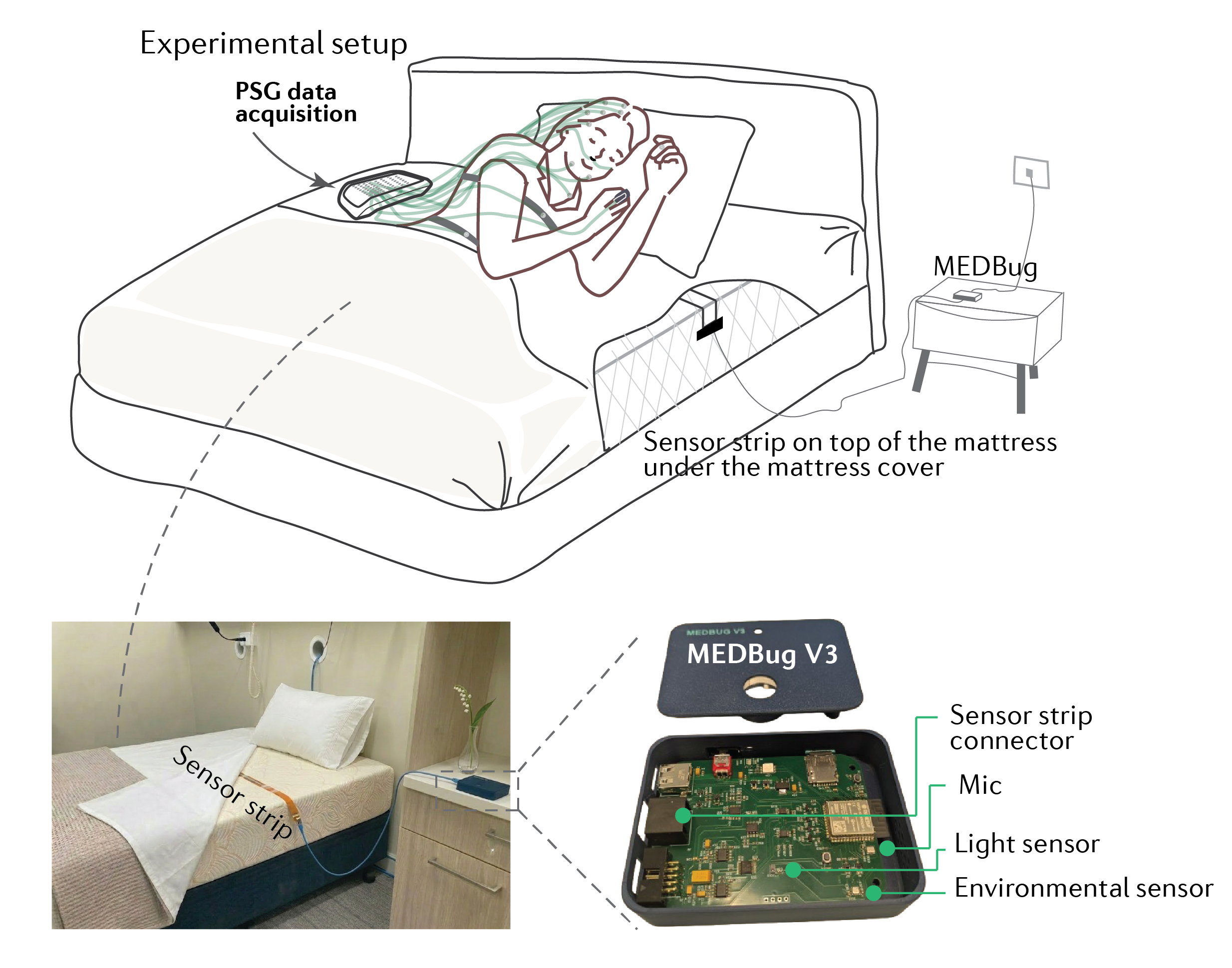 MedBug sleep-staging method overview: mattress sensing to overnight stage output